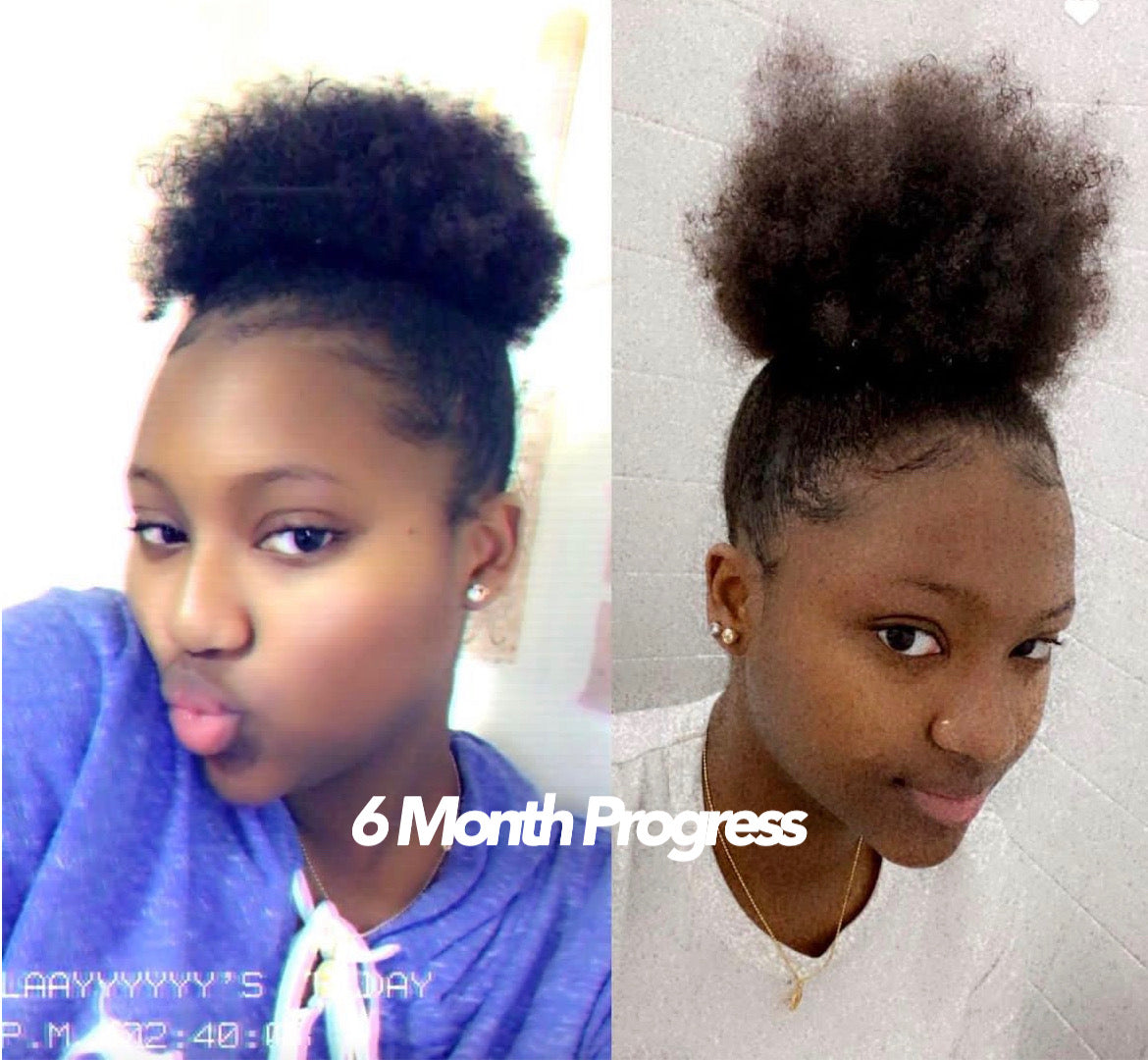 Najah™ - Hair Growth Serum