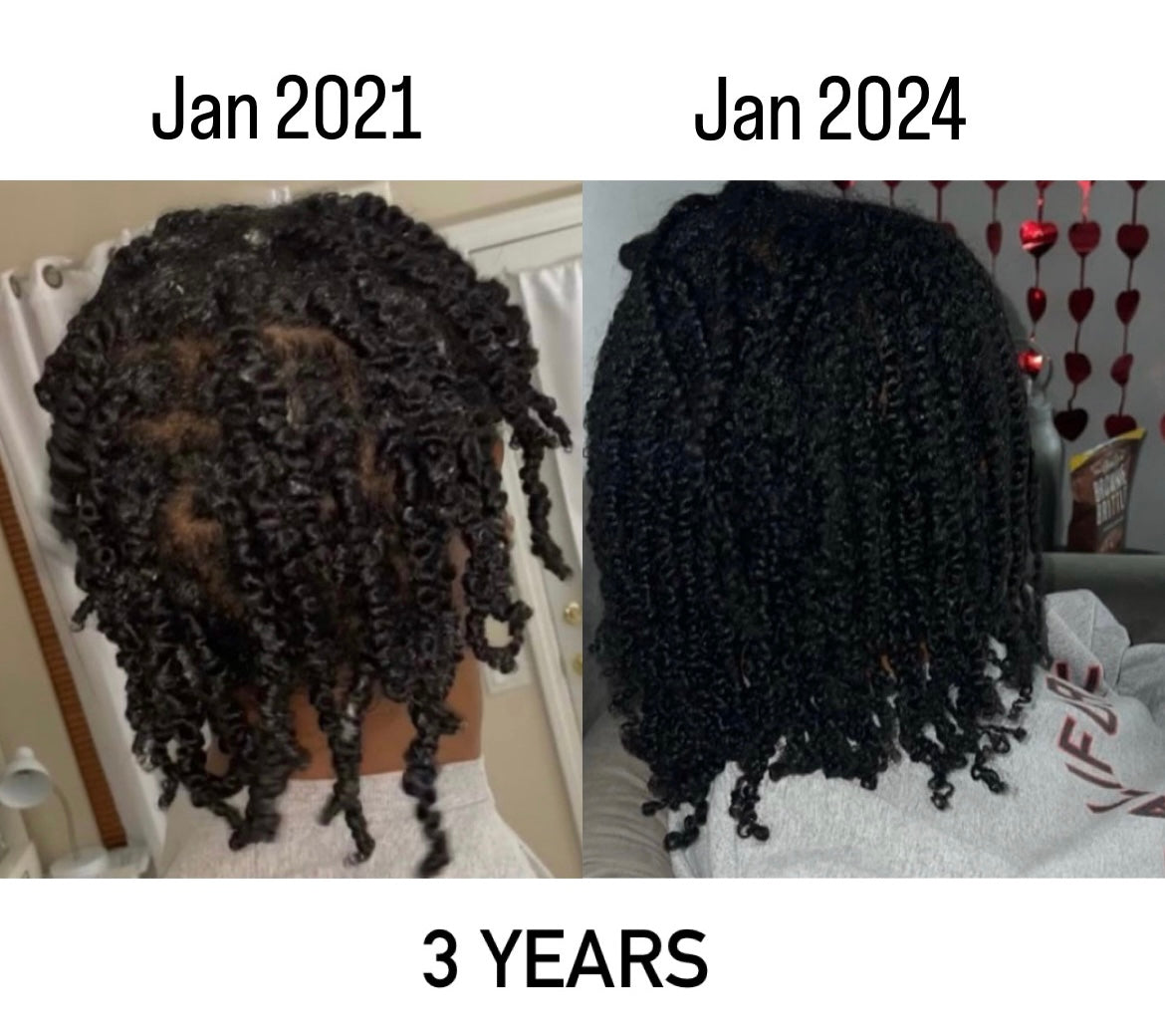 Najah™ - Hair Growth Serum